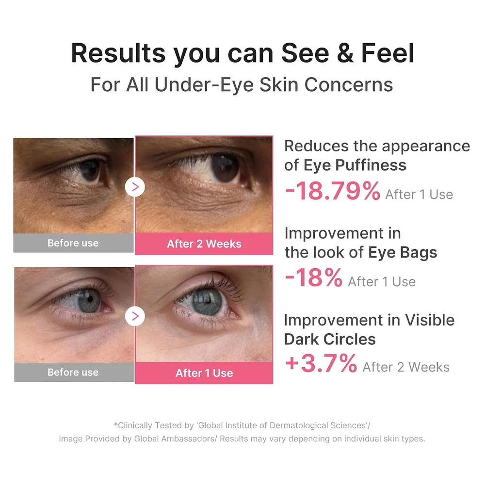 Medicube Hydrogel Eye Patches for Puffiness